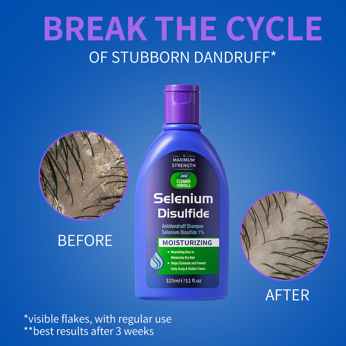 325ml Selenium Disulfide Anti  - Hair Care Dandruff review and price