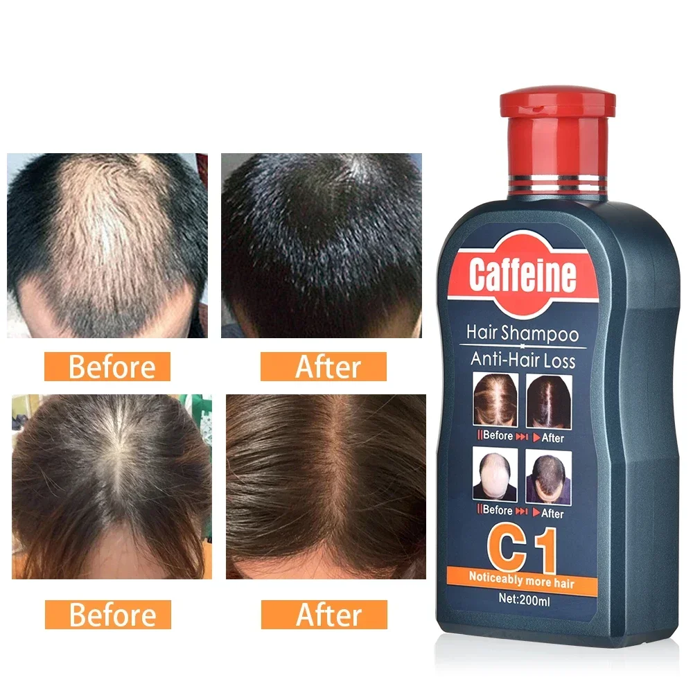 Men Shampoo For Hair Growth Na - Hair Care Korean Products review and price